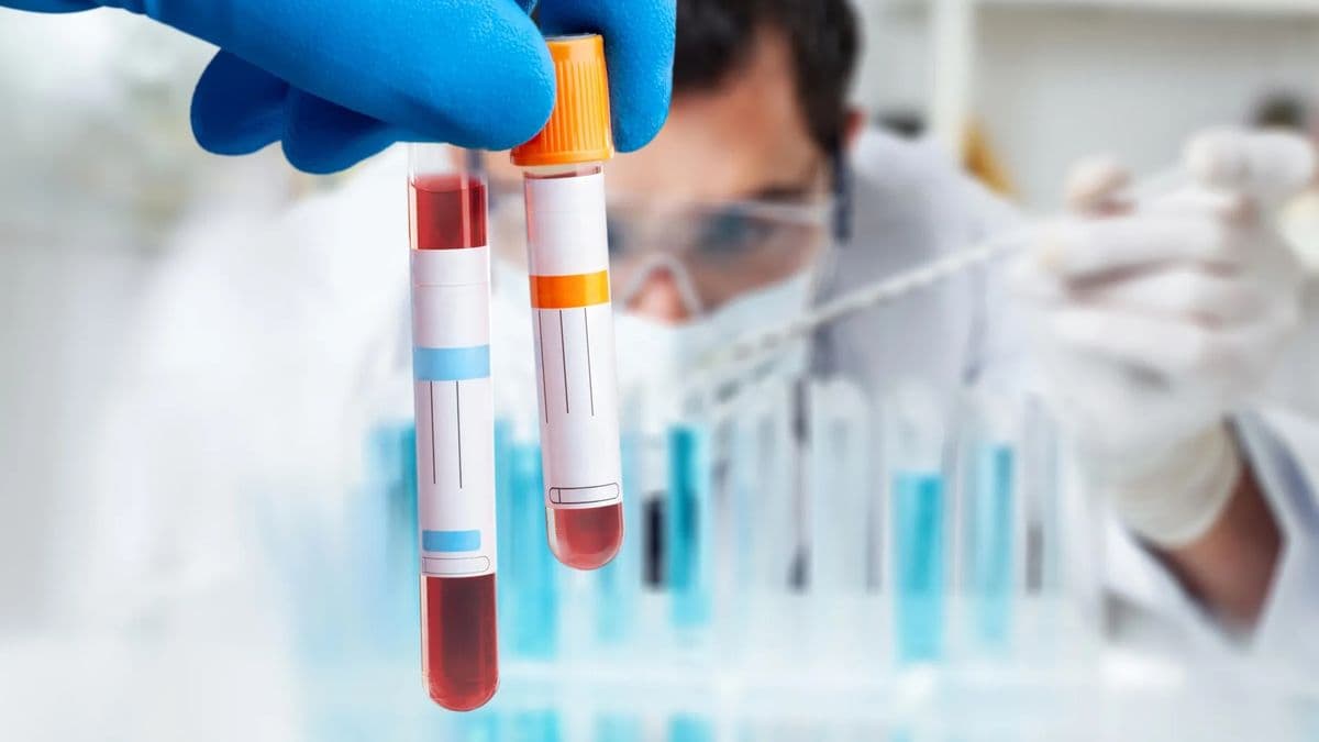 Blood collection tubes held up for testing